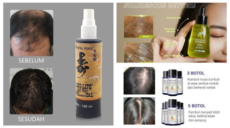 10 Rekomendasi Produk Bonanza Anti Rontok Terbaik untuk Rambut Anda