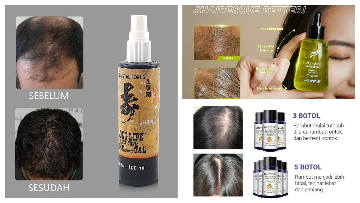 10 Rekomendasi Produk Bonanza Anti Rontok Terbaik untuk Rambut Anda