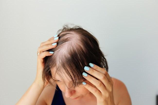 Agen Anti Rungkat – Solusi Terbaik untuk Masalah Rambut Rontok